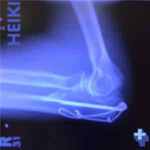 Heiki - Cracked Elbow FLAC