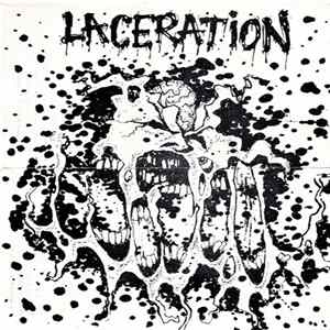 Laceration - Scabs FLAC