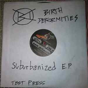 Birth Deformities - Suburbanized FLAC