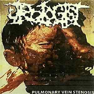 Urologist - Pulmonary Vein Stenosis FLAC