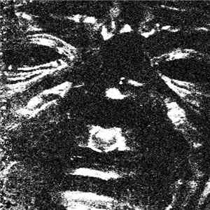Lesion - 2014 Promo Tape I FLAC