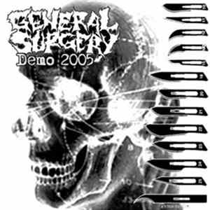 General Surgery - Demo 2005 FLAC