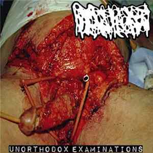 Hydrocephalus - Unorthodox Examinations FLAC