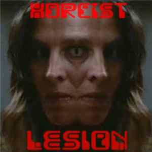 Xorcist - Lesion FLAC