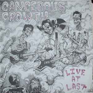 Cancerous Growth - Live At Last FLAC
